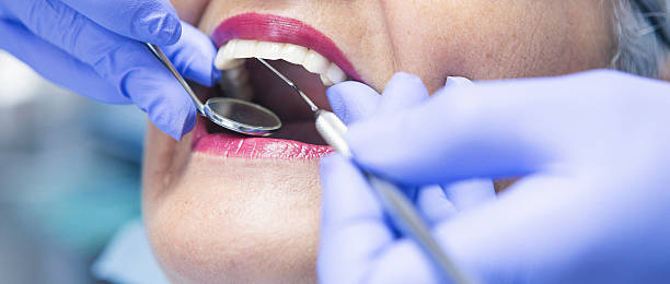 Best Emergency Root Canal Therapy in Crocker, WA